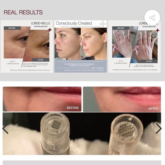 NIB Lorde + Belle Viral RegenPen PEN ONLY - Botox Alternative MSRP $299! - Picture 10 of 14